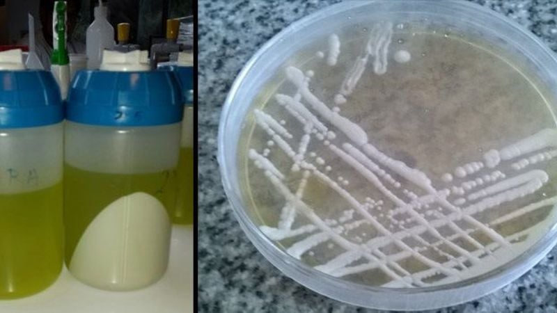 Diseñan una nueva vacuna para combatir la Hepatitis B