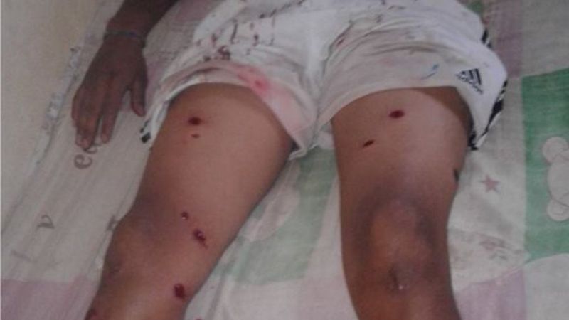 Denuncian brutal agresión policial en Andalgalá