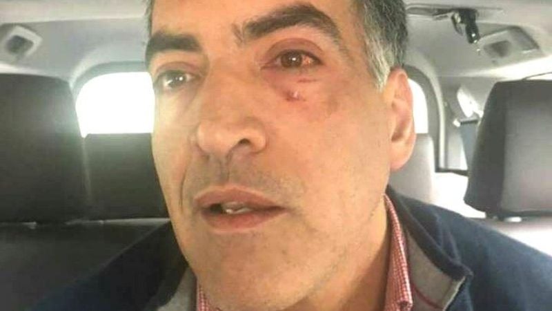 Un hombre murió aplastado por una disputa entre zamoristas