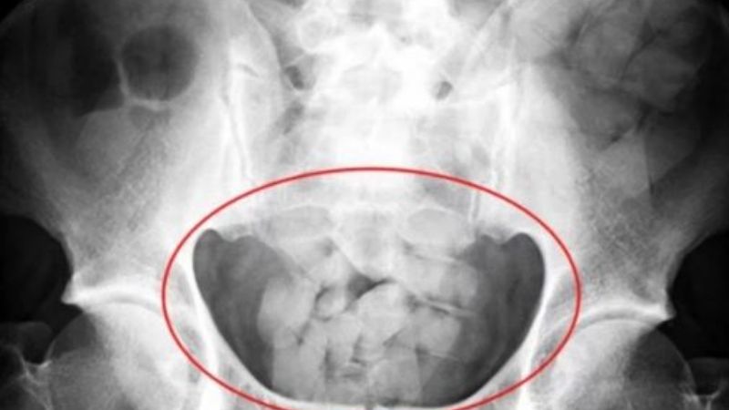Detienen a dos "mulitas" de nacionalidad boliviana