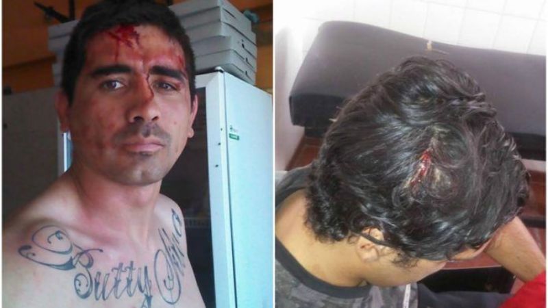 Sangrienta pelea en la calle entre dos boxeadores profesionales