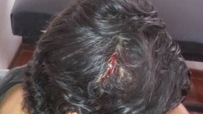 Sangrienta pelea en la calle entre dos boxeadores profesionales