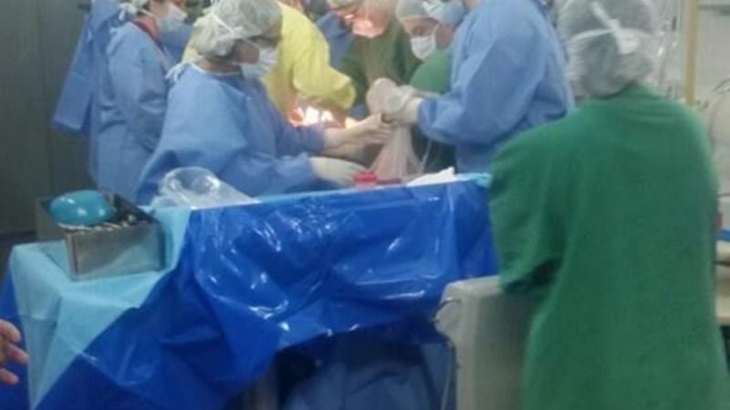 Ablación multiorgánica en el Hospital San Juan Bautista