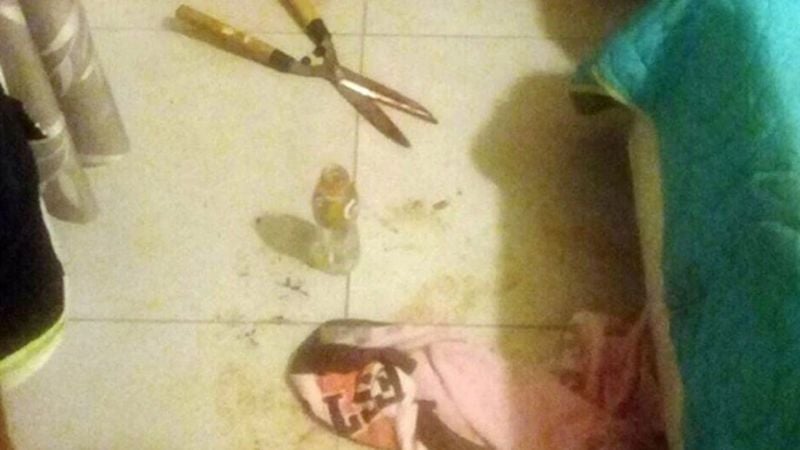 Una joven le cortó el miembro a su amante con una tijera de podar