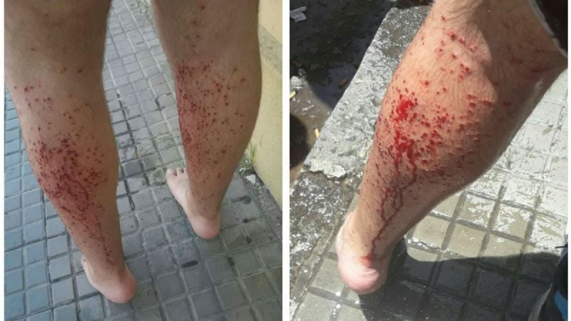 Separan de sus funciones a policías que dispararon a alumnos