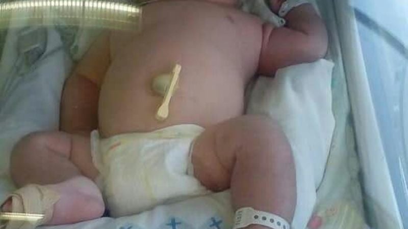 Nació Milton, un súper bebé en la Maternidad de Catamarca