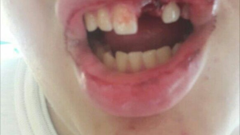 Madre denuncia que su hijo fue golpeado salvajemente