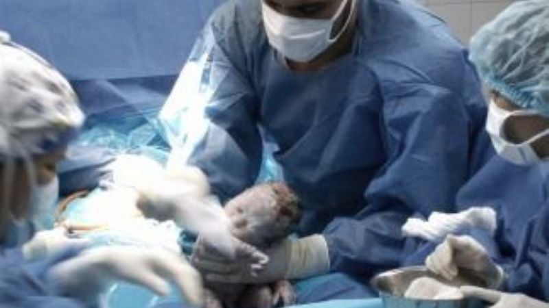 Bebés que tienen doble riesgo de alergia a la leche