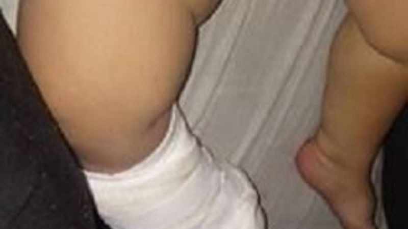 Médico tomó la decisión de atender "gratis" a pacientes quemados