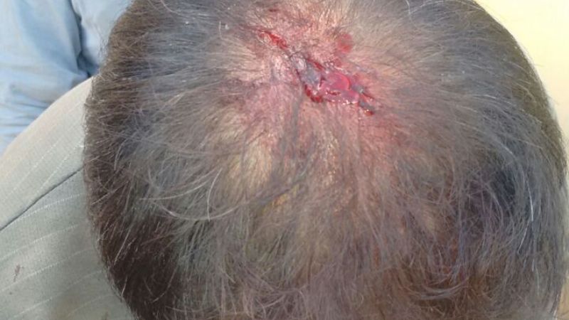 Denuncian represión a municipales en El Alto