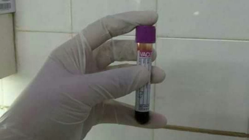 Hospital "Liborio Forte": primera donación de células madre