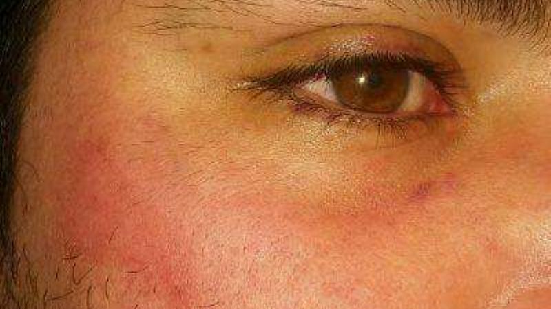 Repercusión nacional de la brutal paliza a neuquino en La Paz