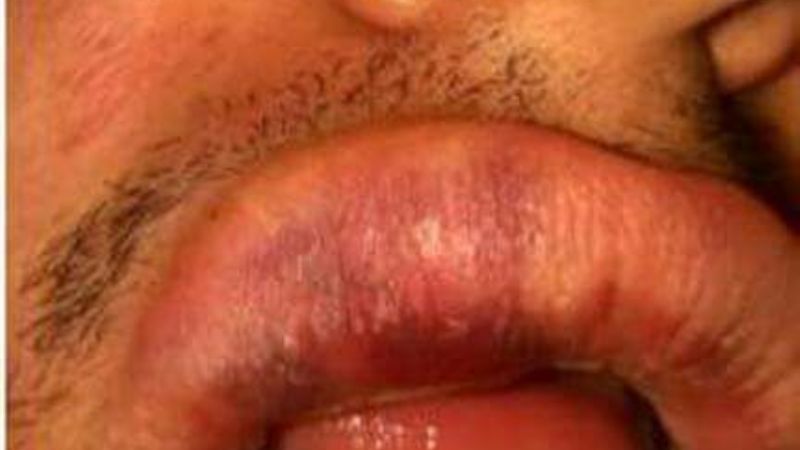 Repercusión nacional de la brutal paliza a neuquino en La Paz