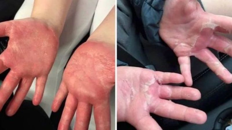 ¡A tener cuidado con el slime, puede ser muy peligroso!