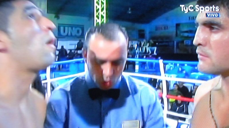 Dura derrota para "El Caballero Azul" Chumbita