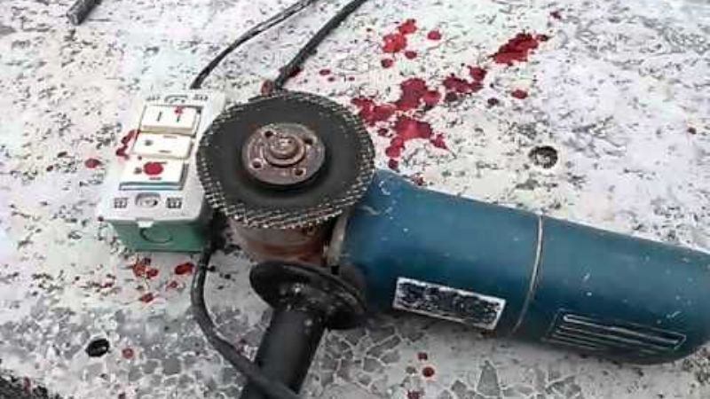 Se cortó el abdomen con una amoladora