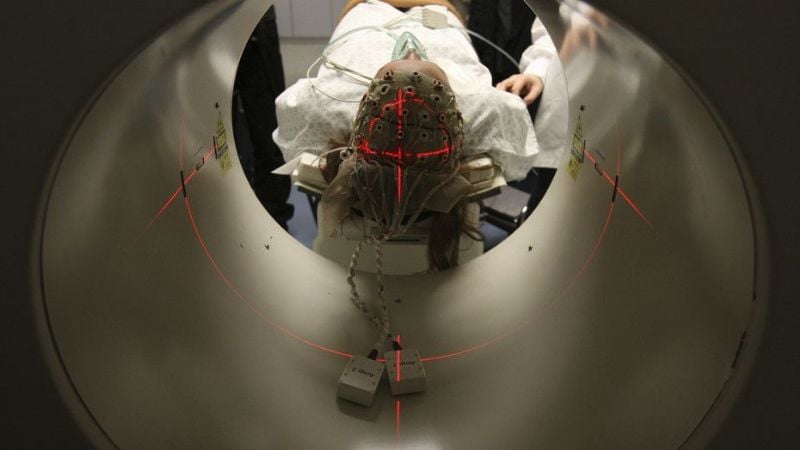 Logran "despertar" la conciencia de un hombre en estado vegetativo