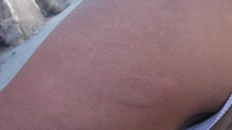 Ánimos caldeados: Municipales de Recreo endurecen el reclamo