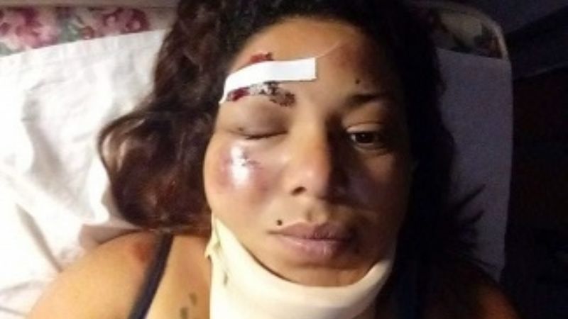 Se desvaneció mientras manejaba la moto y sufrió graves heridas