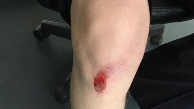 Asaltaron en Puerto Madero a un experto canadiense que vino a cubrir el G-20