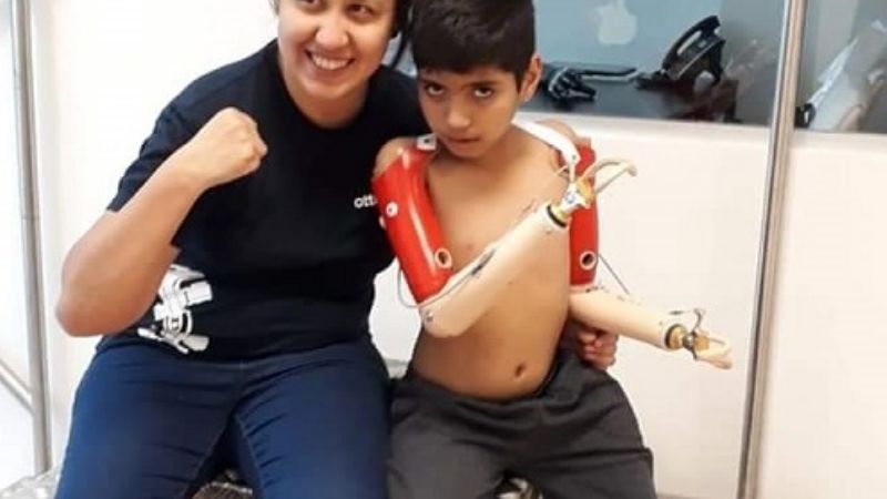 Javi ya tiene sus prótesis de brazos