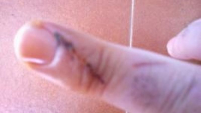 Septuagenario en estado de ebriedad le cortó un dedo a una mujer