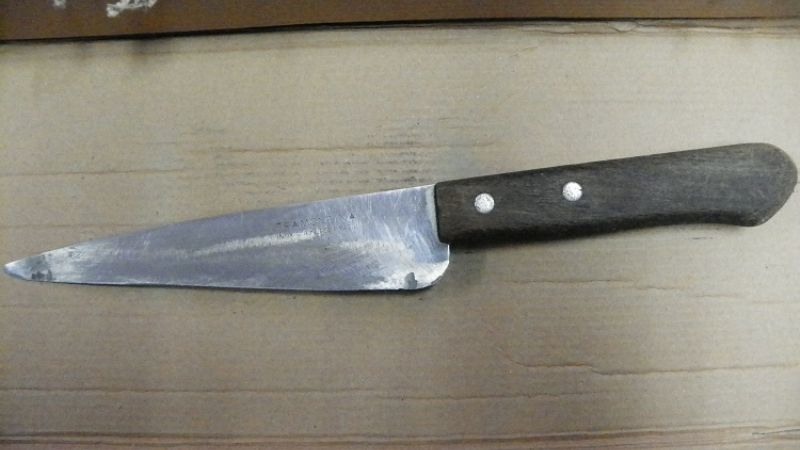 Mujer denunció a su hija por cortarle dos dedos