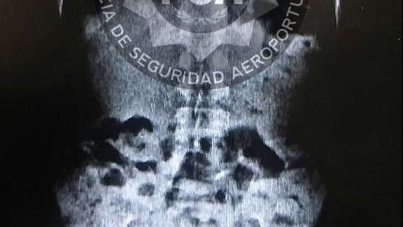 Detuvieron a una “mula” en el aeropuerto de Ezeiza