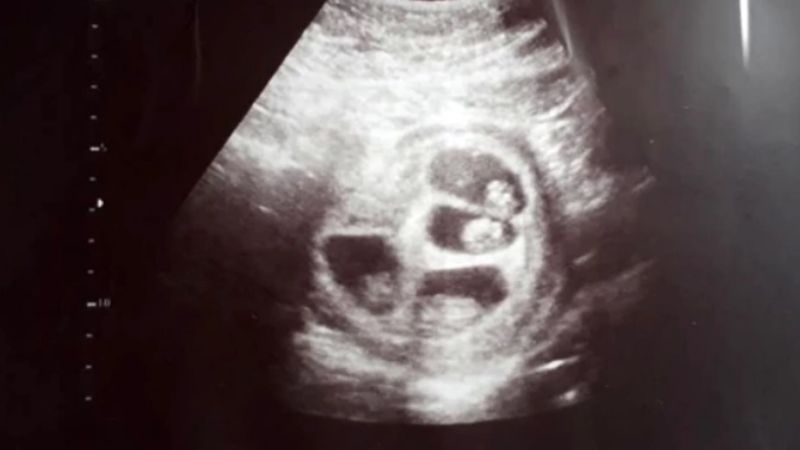 Una gran historia de amor que comenzó hace muchos años en Catamarca