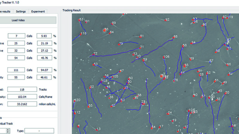 Estudiando espermatozoides en carrera