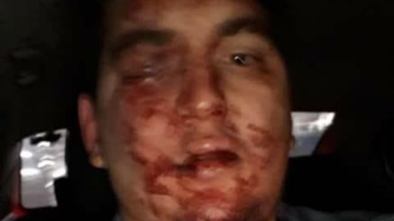 Terrible golpiza a un joven en la zona alta