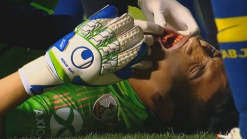 El arquero Andrada sufrió una fractura de mandíbula