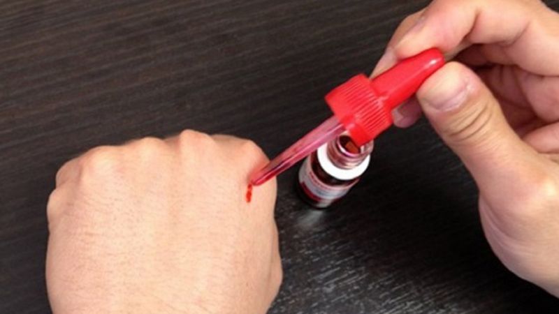 Prohíben el uso y la venta en todo el país de un iodo