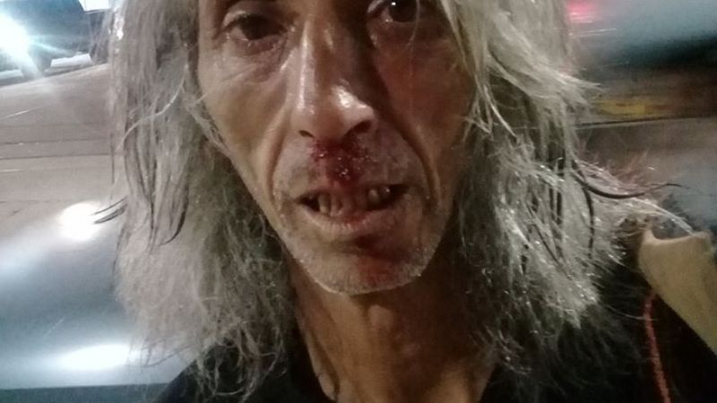 Agredieron al “Topo” por no querer grabar un video