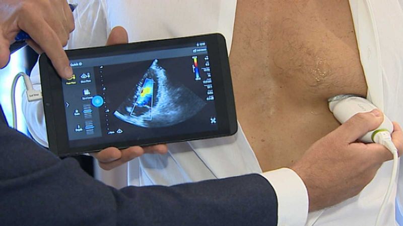 Prohíben el uso y la compra de un ecógrafo portátil