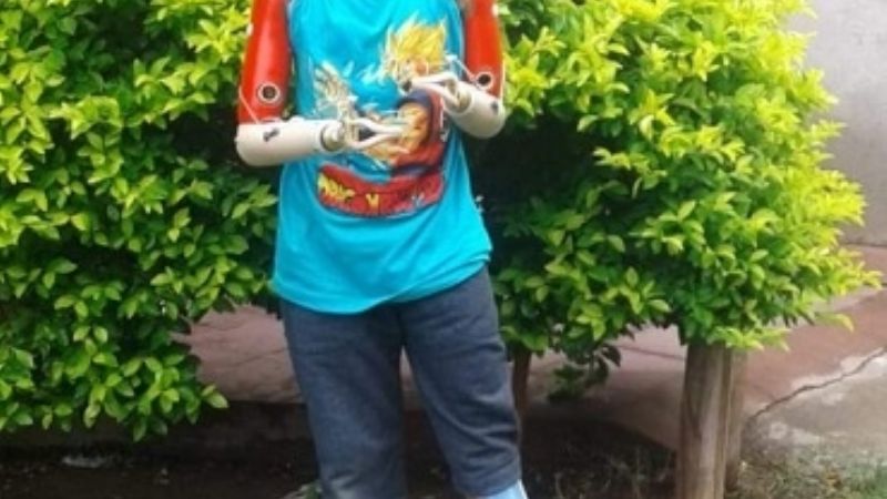 Javi ya tiene sus brazos y pierna