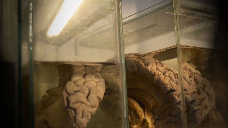 Las enfermedades neurodegenerativas aumentarán exponencialmente