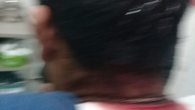 Militantes del “Frente de Todos”, víctimas de brutal golpiza en Belén