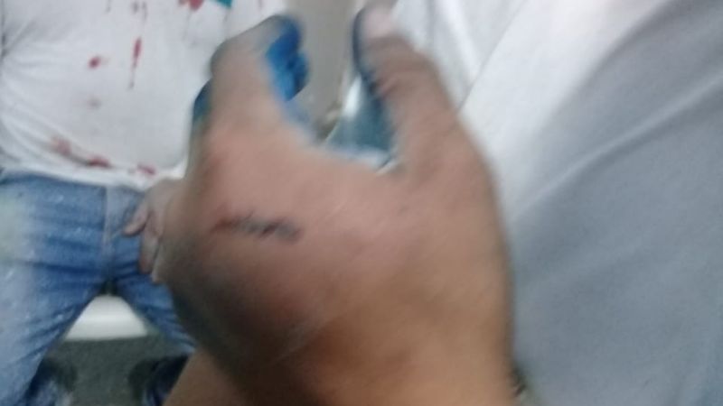 Militantes del “Frente de Todos”, víctimas de brutal golpiza en Belén