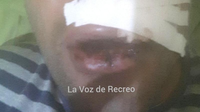 Policía quedó inconsciente en confuso episodio