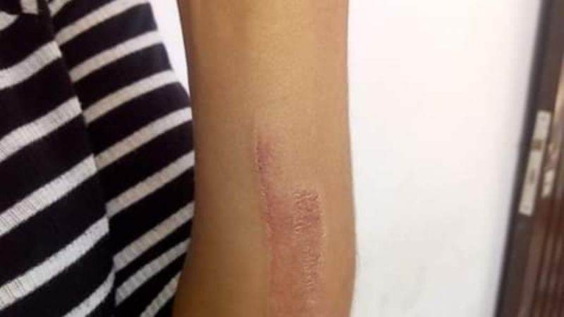 Queman gomas frente a la Municipalidad de Recreo