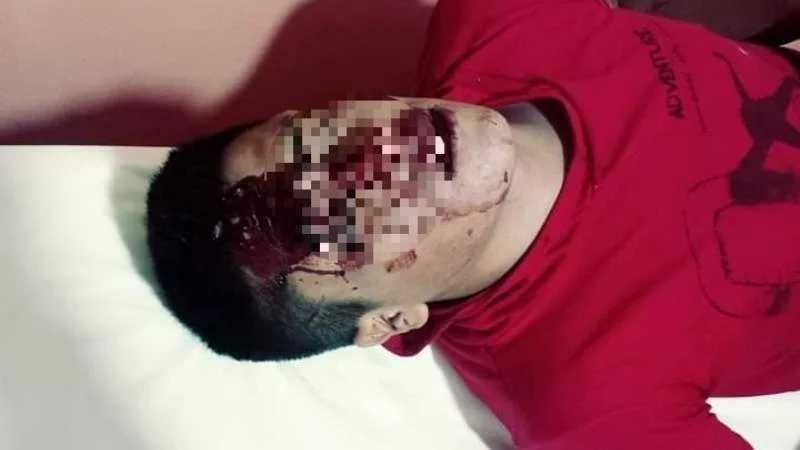 Brutal golpiza a un joven en Belén