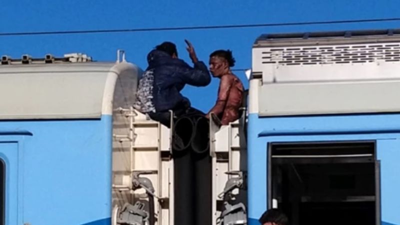 Pasajero electrocutado por subirse al techo del tren tiene el 70% del cuerpo quemado