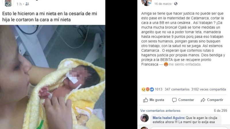 Denuncian que le cortaron la boca a una beba en una cesárea