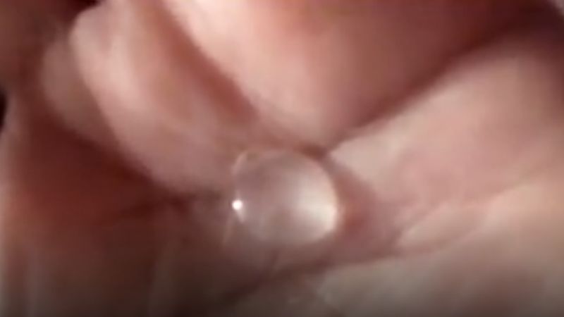 Chaparrón y caída de granizo en Chumbicha