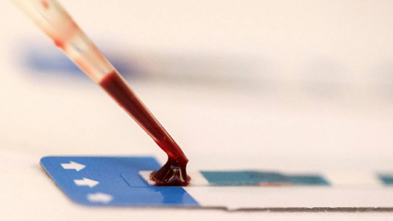 Se curó un tercer paciente con VIH tras un transplante