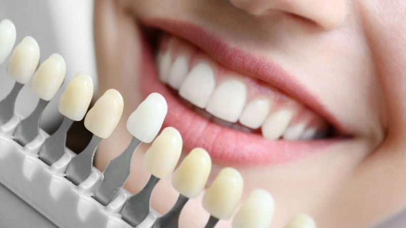 Prohíben la venta de un implante dental y otros productos médicos