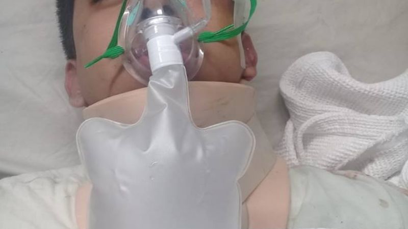 Salvaje golpiza a un adolescente que acompañaba a sus amigas