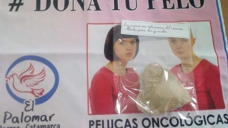 Agrupación El Palomar entrega pelucas oncológicas