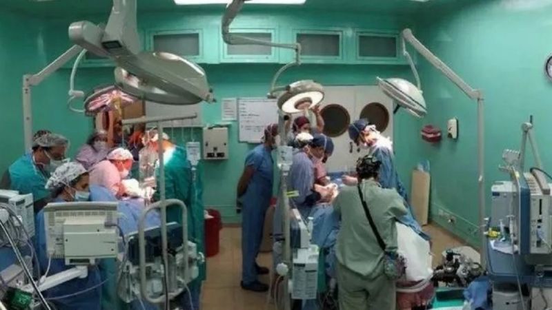 Más de 40 médicos separaron a siameses en una cirugía sin precedentes